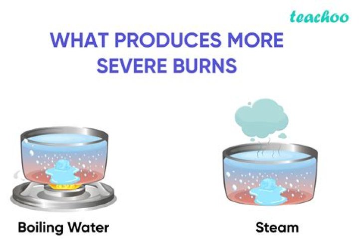 Are steam burns worse? | ContextResponse.com