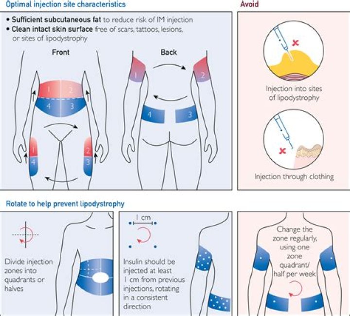 Can NPH insulin be given IV?