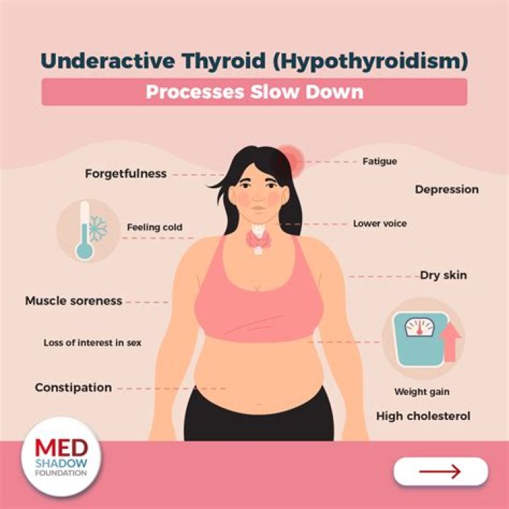 Can underactive thyroid cause eye problems?