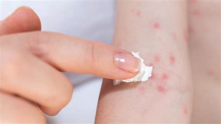 Can you be allergic to mulch?