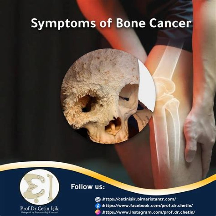 Can you die from a bone infection?