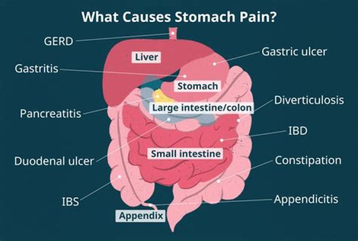 Does Advil cause stomach pain?