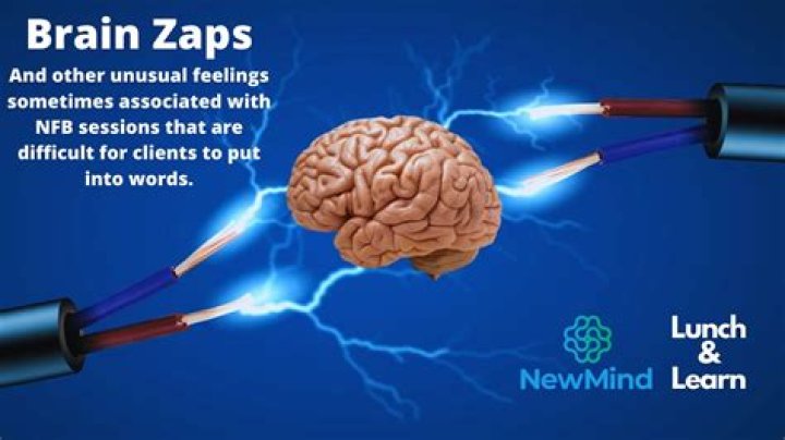 How do you stop brain zaps from sertraline?
