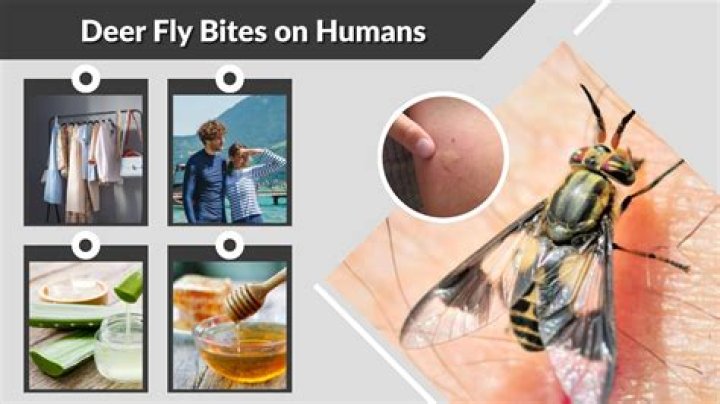 How do you treat deer fly bites on humans?