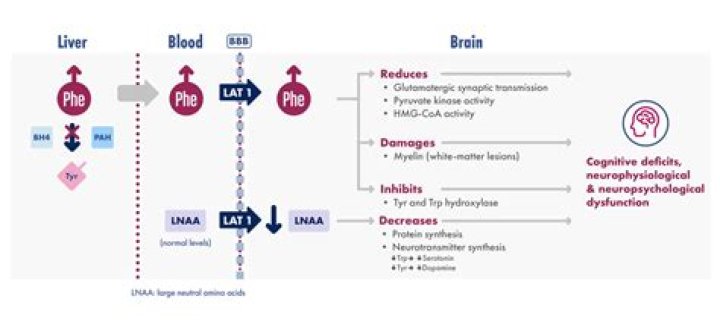 How does PKU affect the brain?
