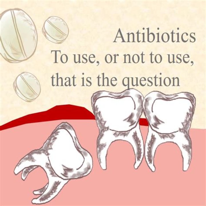 How long do you take antibiotics for wisdom teeth?
