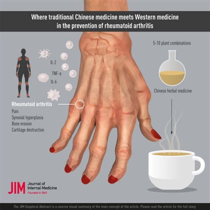 Is there a new cure for rheumatoid arthritis?