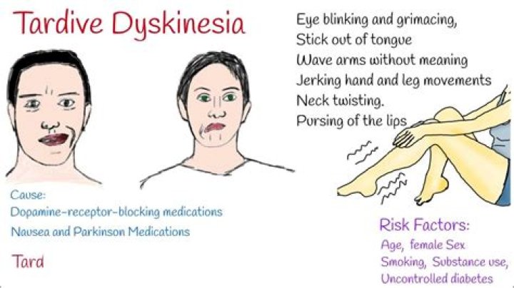 What are the causes of tardive dyskinesia?