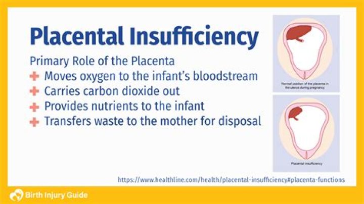 What causes placental insufficiency? | ContextResponse.com
