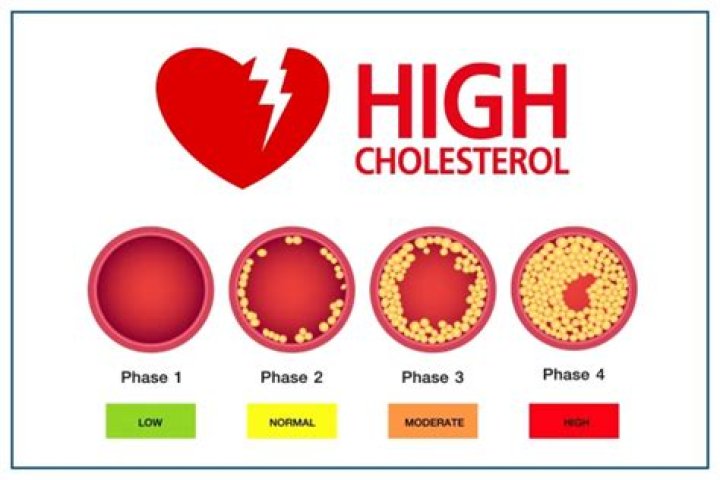 What does high LDL mean?