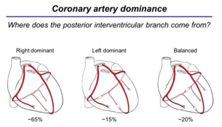 What does right coronary dominance mean?