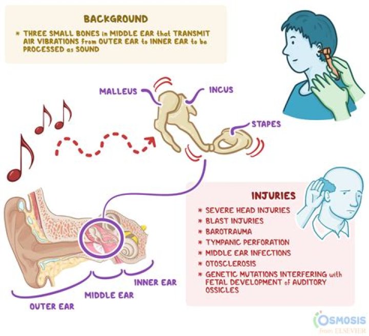 Why do I hear a static noise in my ear?